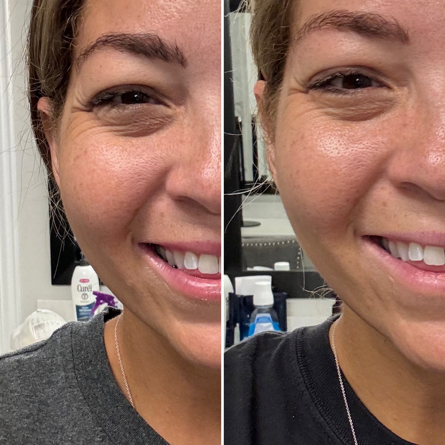 retinol > 1-2 month supply