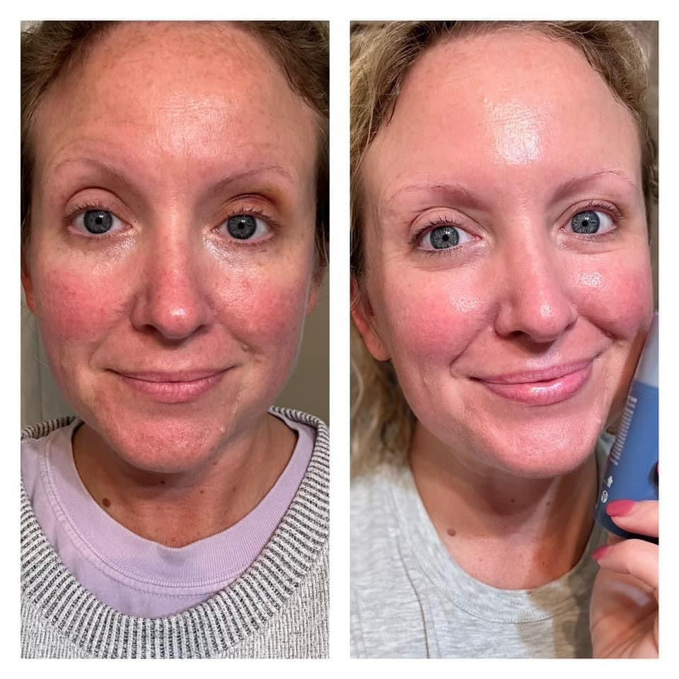 retinol > 1-2 month supply
