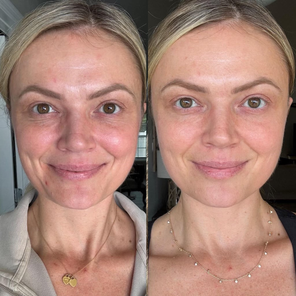 retinol > 1-2 month supply